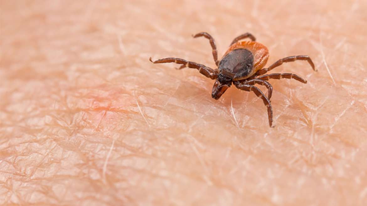 Kleiner Stich mit großem Schaden? Die von Zecken übertragene FSME